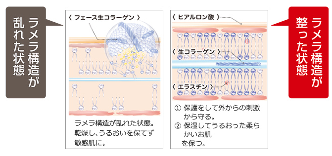 コラーゲン ラメラ美容法